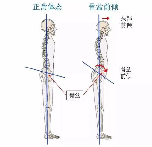 骨双轨征：一种重要的医学影像学表现及其临床意义