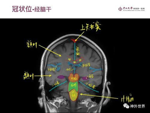 暴躁老阿姨CSGO技能推荐大全：提升游戏水平的实用技巧与策略